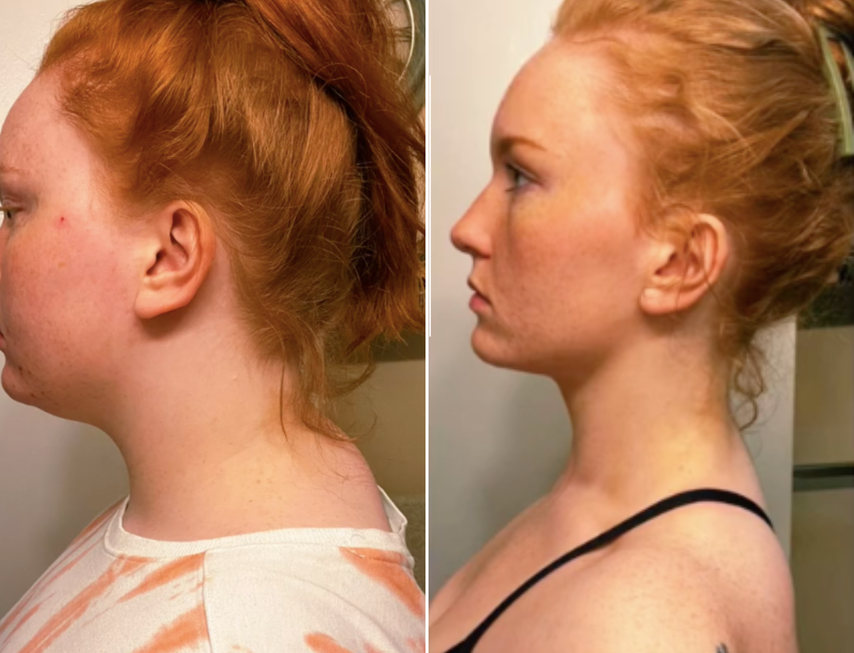 The original Neck Cloud Stretcher for fast neck and shoulder pain relief. Simple, effective cervical traction to ease tension, stiffness, and improve posture.
