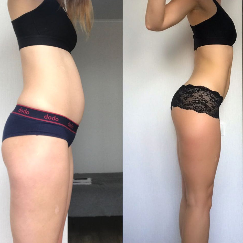 Nuvi™ Ankle Straps