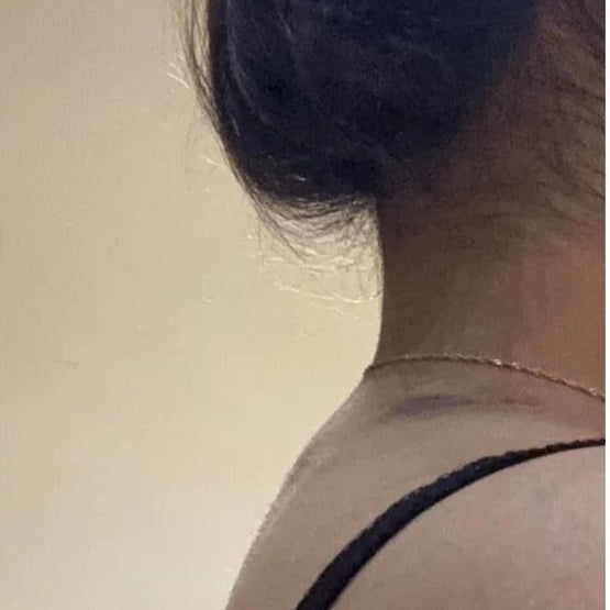 The original Neck Cloud Stretcher for fast neck and shoulder pain relief. Simple, effective cervical traction to ease tension, stiffness, and improve posture.
